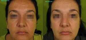 Spot-Peel-318-I-e1347487235949